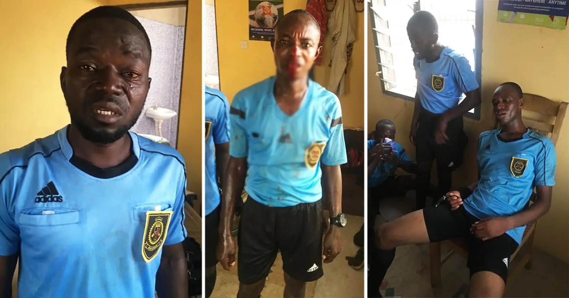 Scene scioccanti in Ghana: gli arbitri di calcio coperti di sangue dopo la partita