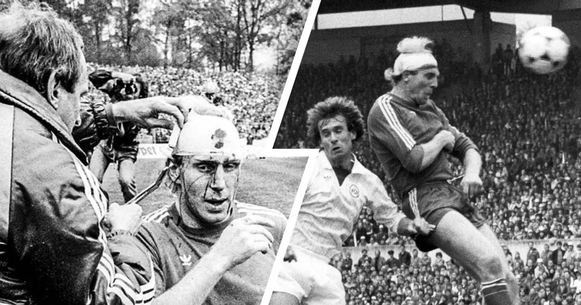 Heute vor 41 Jahren: Als Dieter Hoeneß trotz Platzwunde am Kopf zum Pokal-Helden wurde