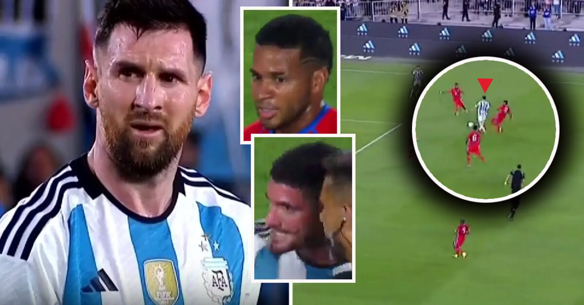 Was haben sie sich dabei gedacht? Messi wurde in einem FREUNDSCHAFTSSPIEL von 2 Panamaern auf einmal attackiert - Argentinier erlitt dabei eine blutige Wunde