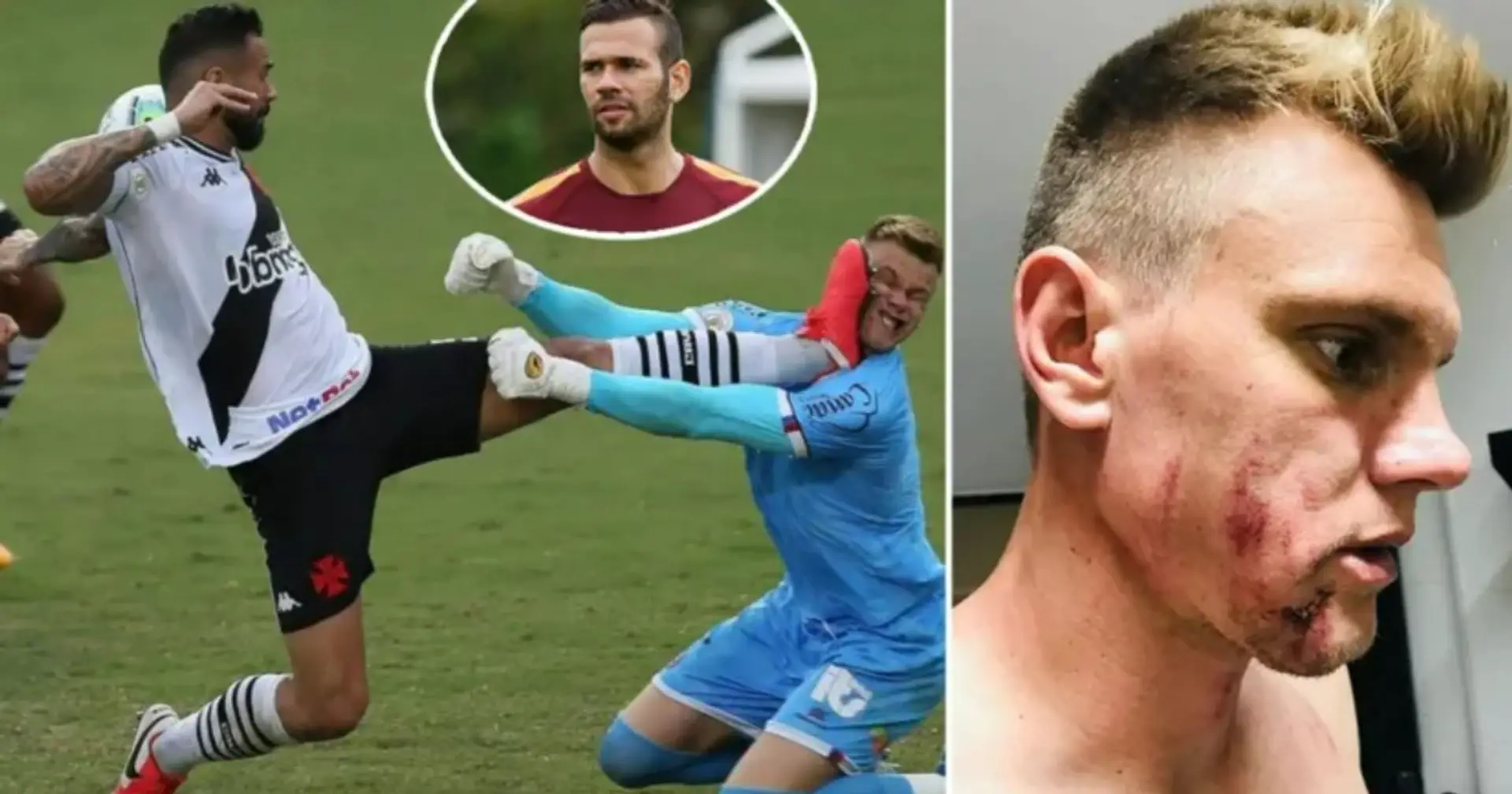 Castan's killer foul: opposition goalkeeper takes a big risk and leaves the pitch with a swollen face