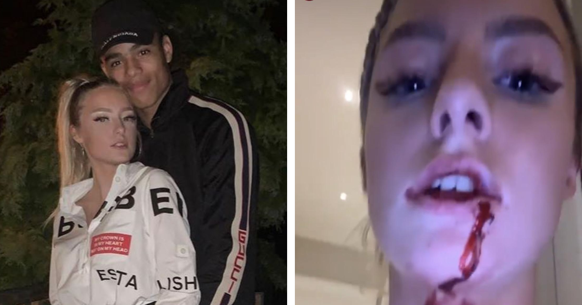 Greenwood's girlfriend shares photos of bleeding and severe bruises, claims  'Mason does it to her' - Football