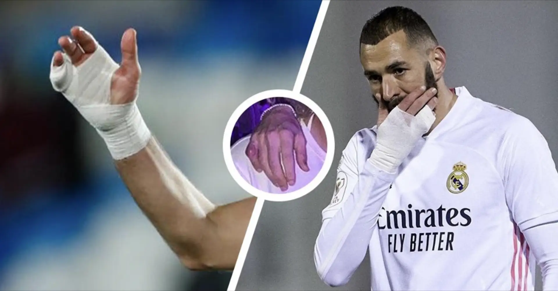 'How long has it been going on?' The big story behind Karim Benzema's little finger