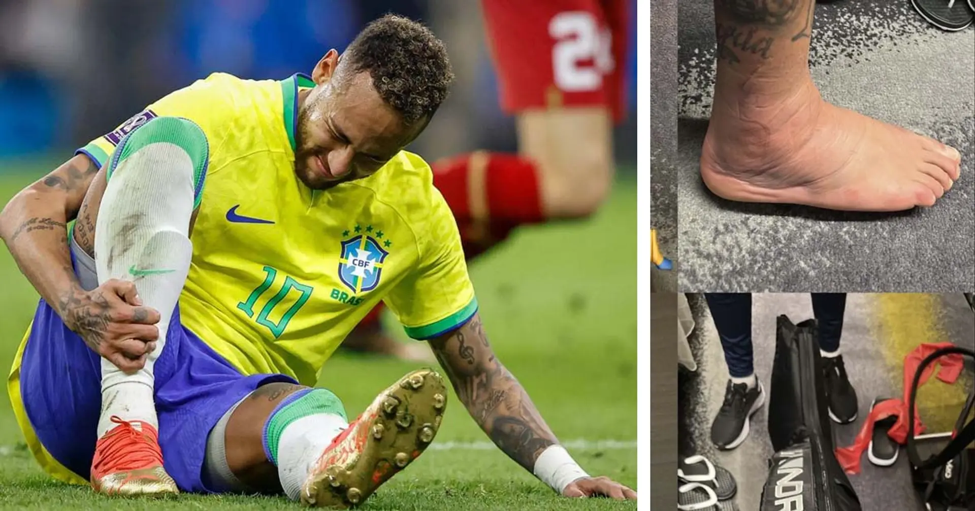 Neymar montre des images très inquiétantes de sa cheville blessée 