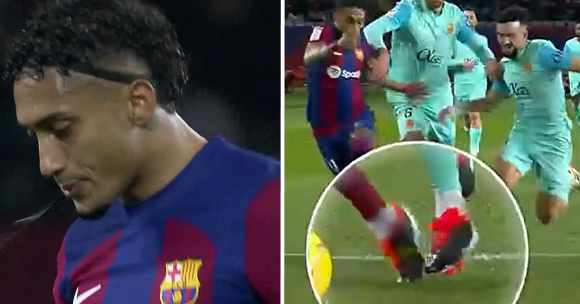 Raphinha pays heavy price for winning penalty for Barca, suffers THIRD injury of season