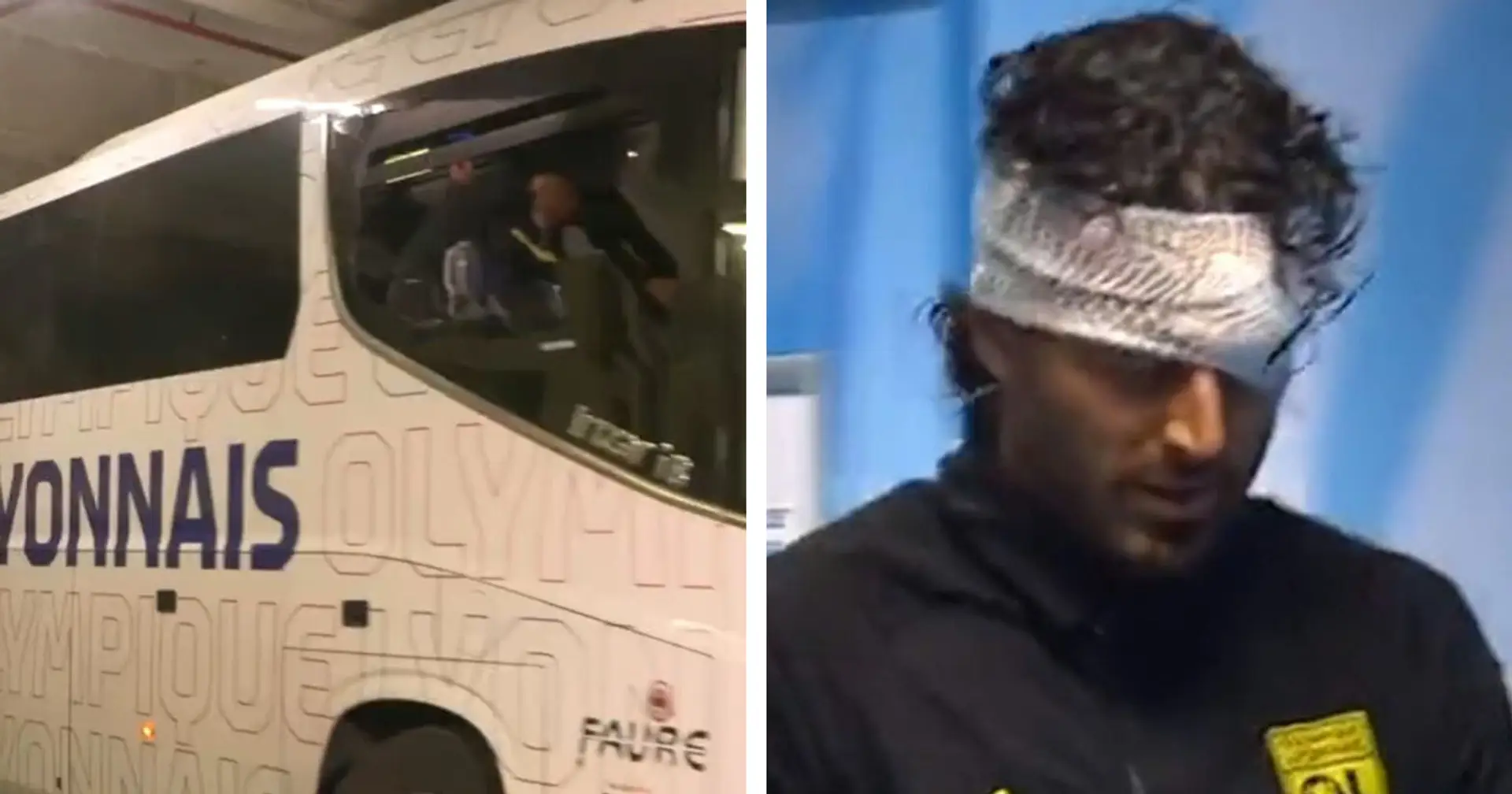 Sassaiola contro il bus del Lione: ferito l'allenatore ed ex Juve Fabio Grosso prima del match con il Marsiglia
