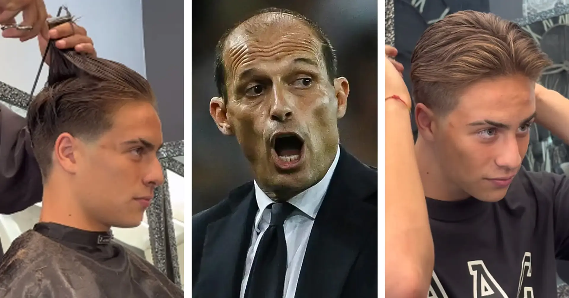 Yildiz fa felice 'papà' Allegri: il fantasista della Juventus non si toccherà più i capelli '100 volte a partita'
