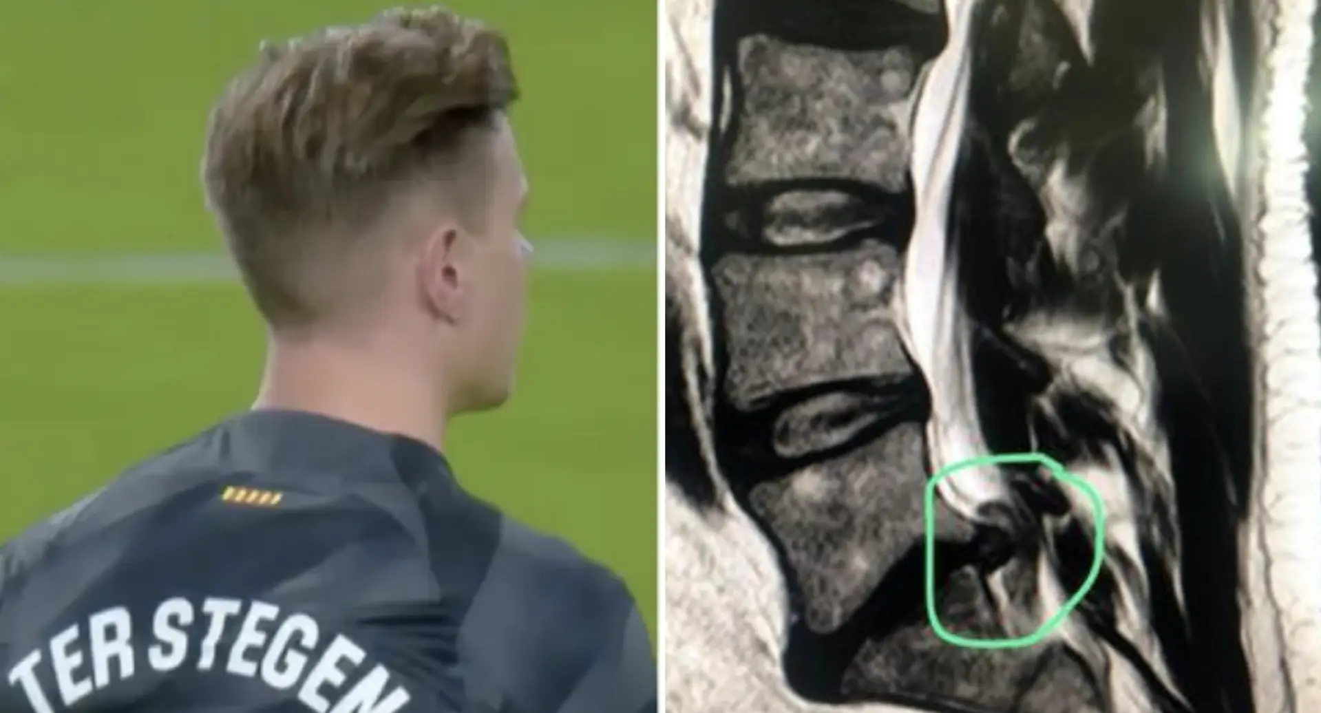 Confirmed: Ter Stegen to undergo back surgery, recovery time revealed