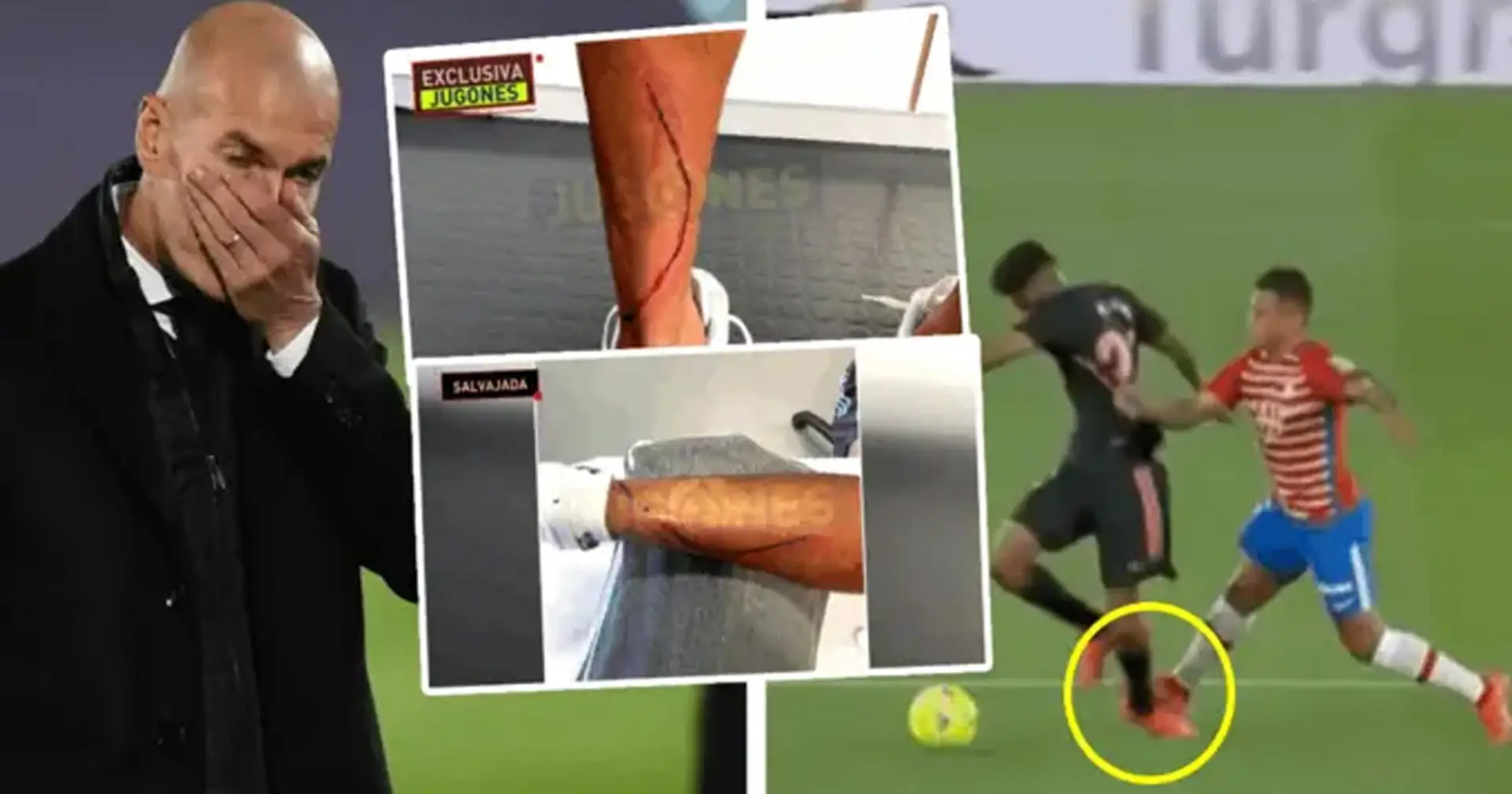 Imágenes del tobillo de Marvin después de la terrible falta de Machis se vuelven virales en redes sociales