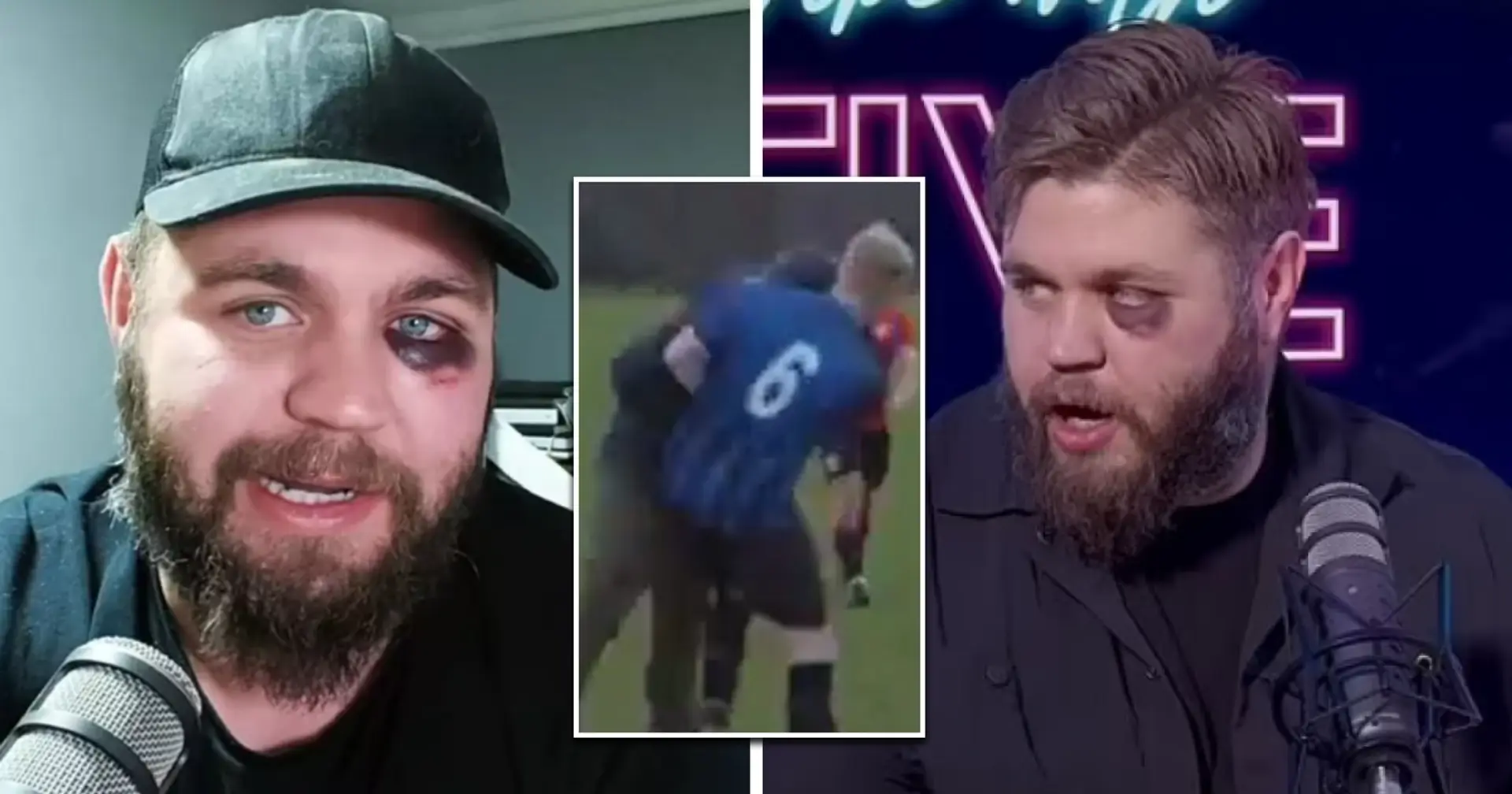 Ferdinand's YouTube host throws punches and headbutt to spark football brawl, ends up with a black eye