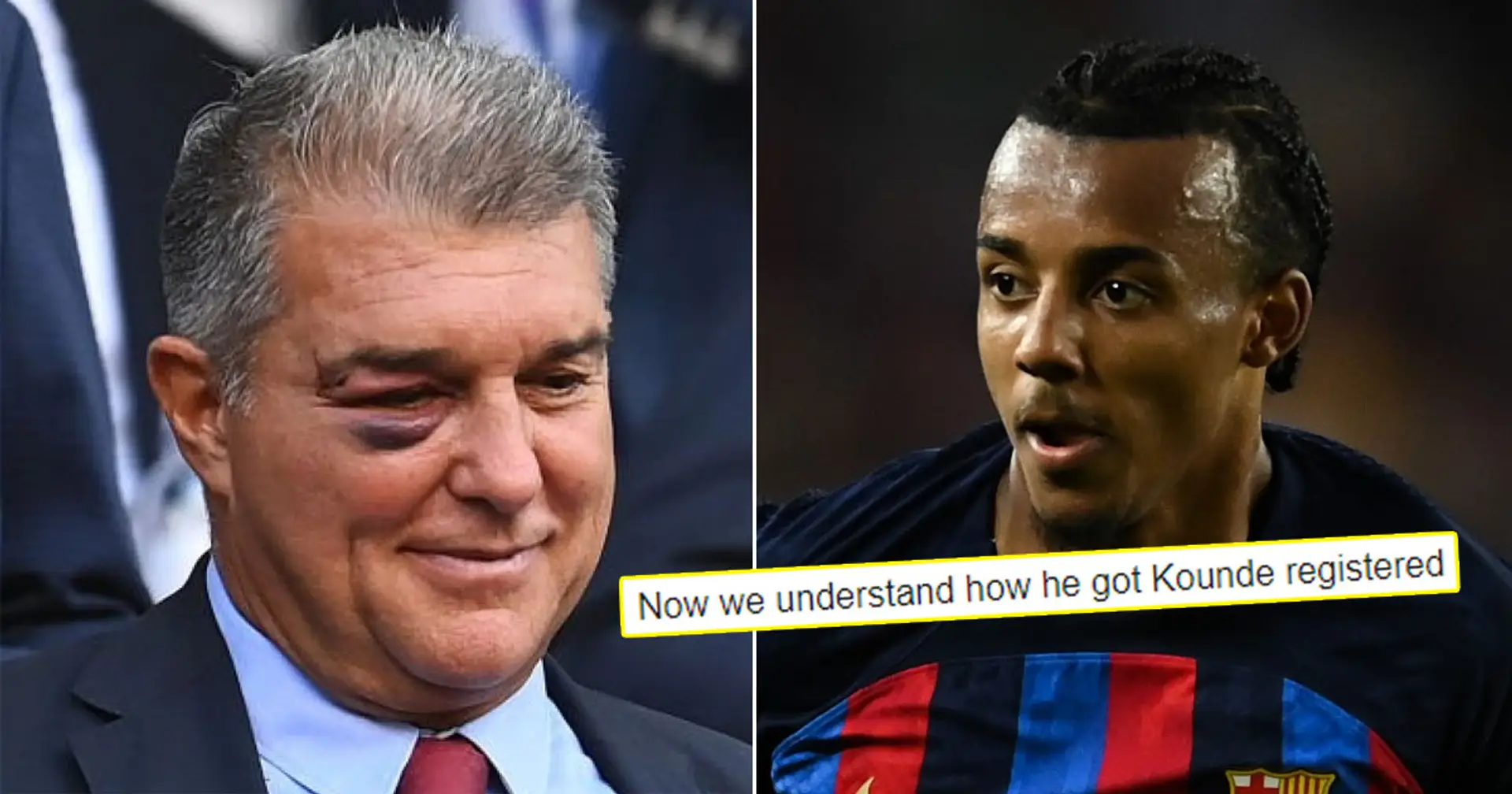 Fans suspect one man as Laporta is spotted with black eye at Barca game