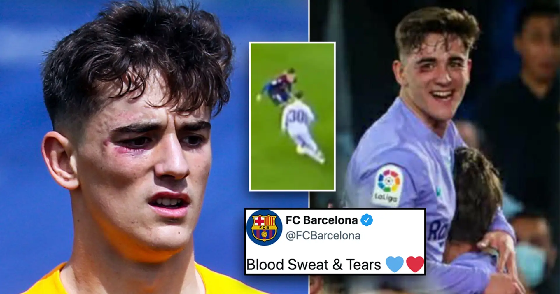 Gavi suffers painful bruise v Levante – this happens for 3rd time this season