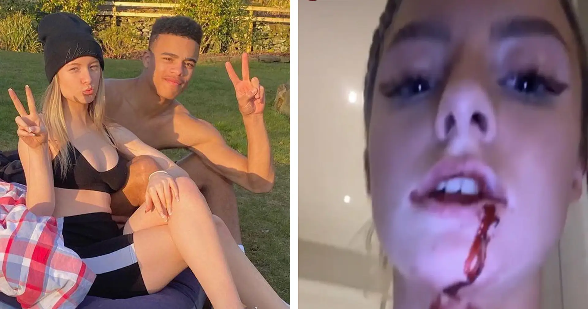 Greenwood's girlfriend shares shocking photos of beatings, leaks audio of Mason forcing himself on her
