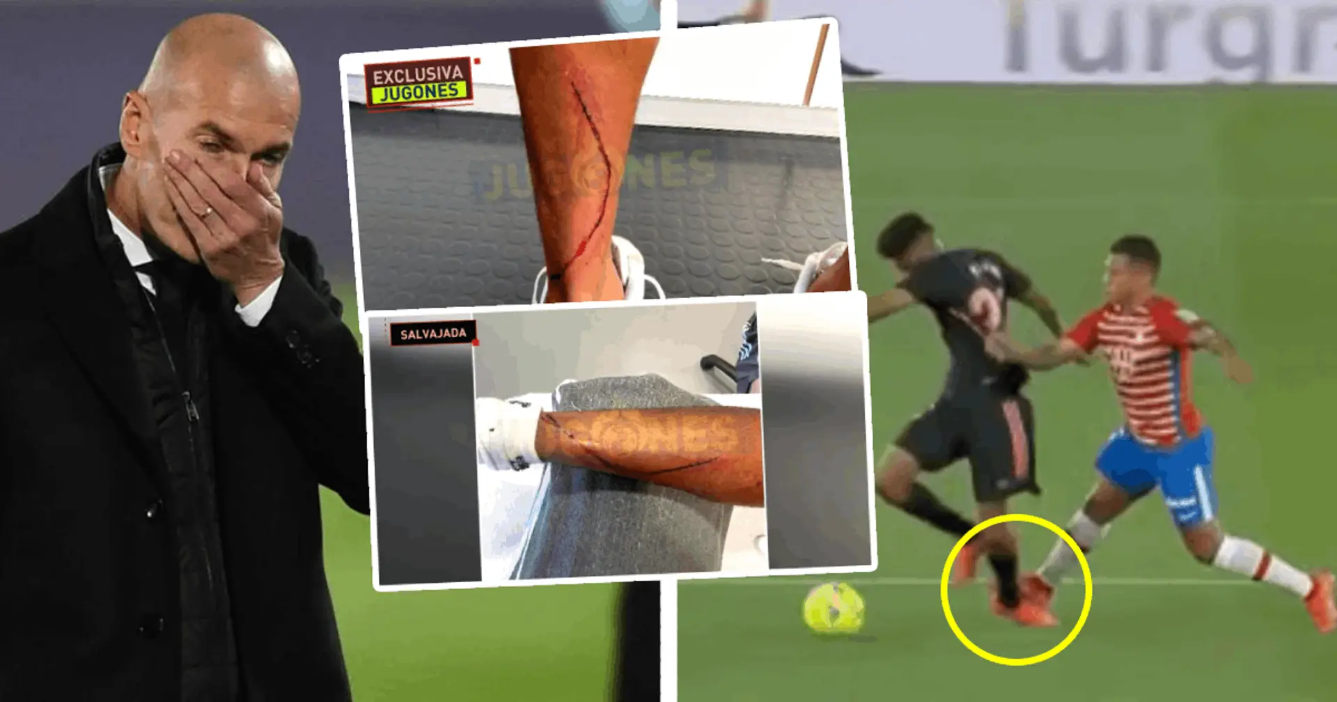 Pictures of Marvin's damaged ankle after horror tackle by Machis go viral on social media