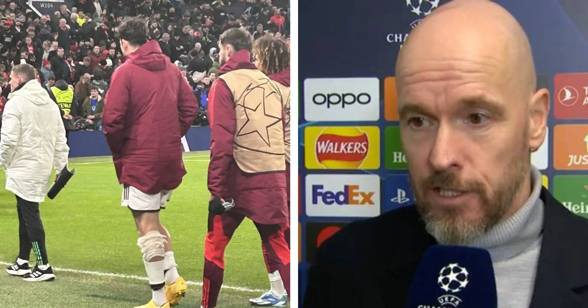 Maguire spotted with bandaged leg after Bayern defeat - Ten Hag shares update
