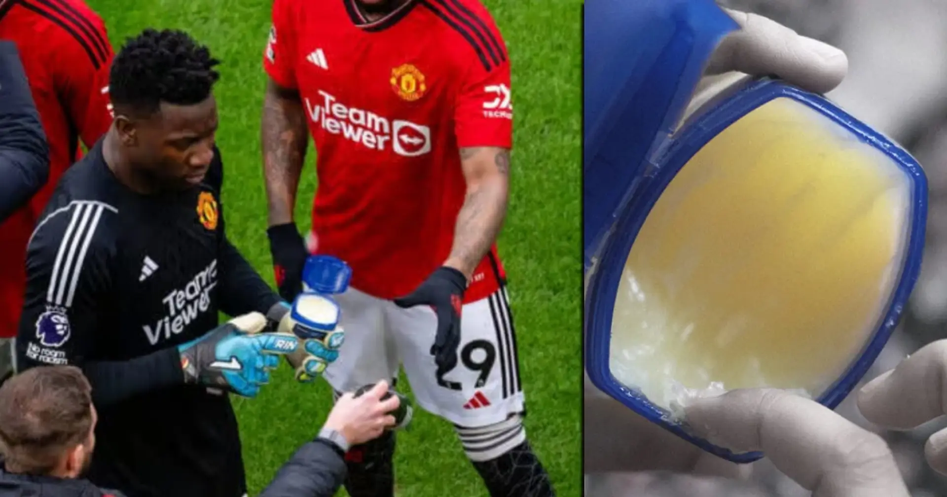 Why Andre Onana puts Vaseline on his gloves