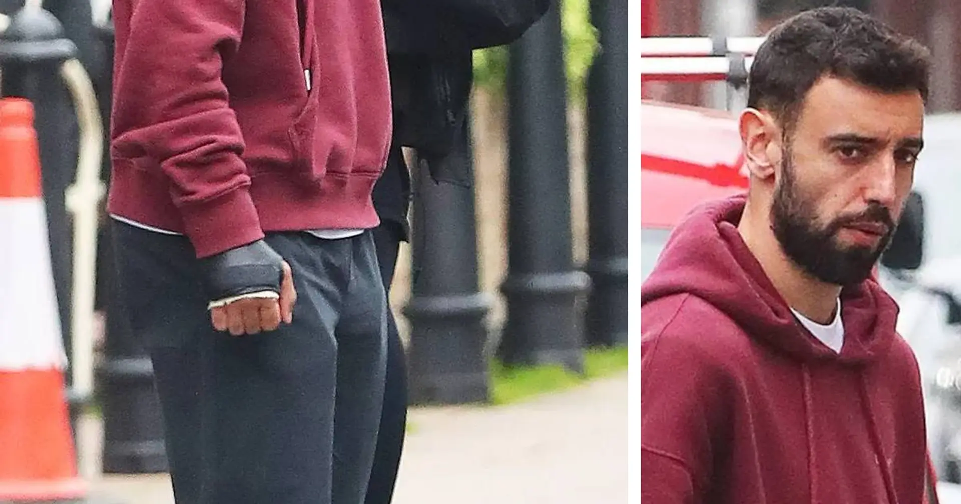 Spotted: Bruno Fernandes wears protective cast ahead of Crystal Palace clash
