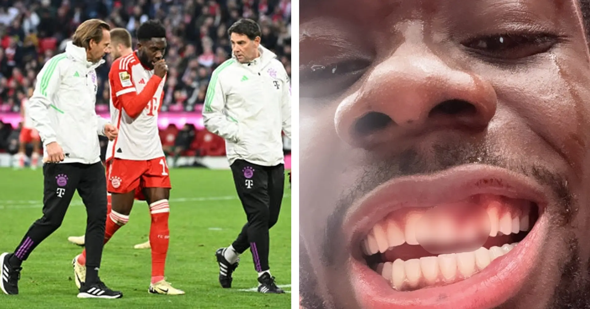 Igitt... Alphonso Davies postet auf Instagram ein Foto seiner Zähne nach dem Spiel vs. Mainz