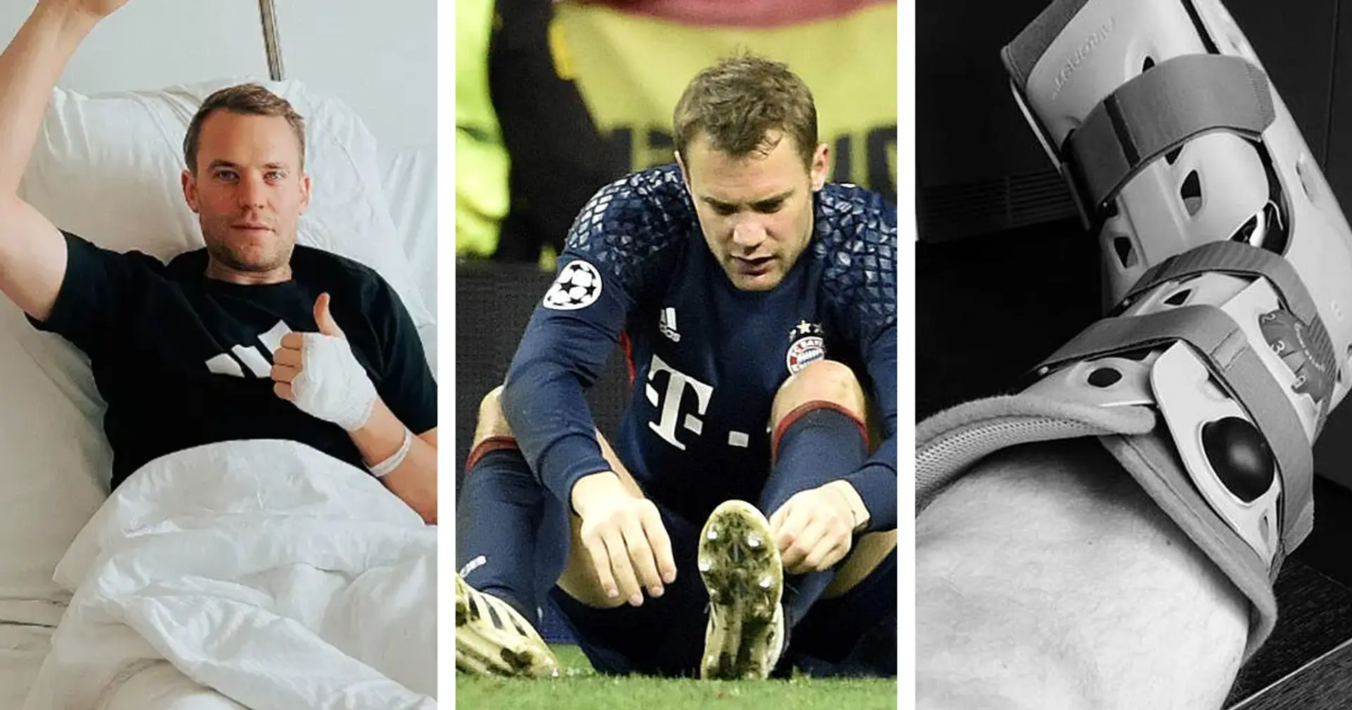 Die ganze Liste der Verletzungen von Manuel Neuer - seit 2021 passieren sie häufiger