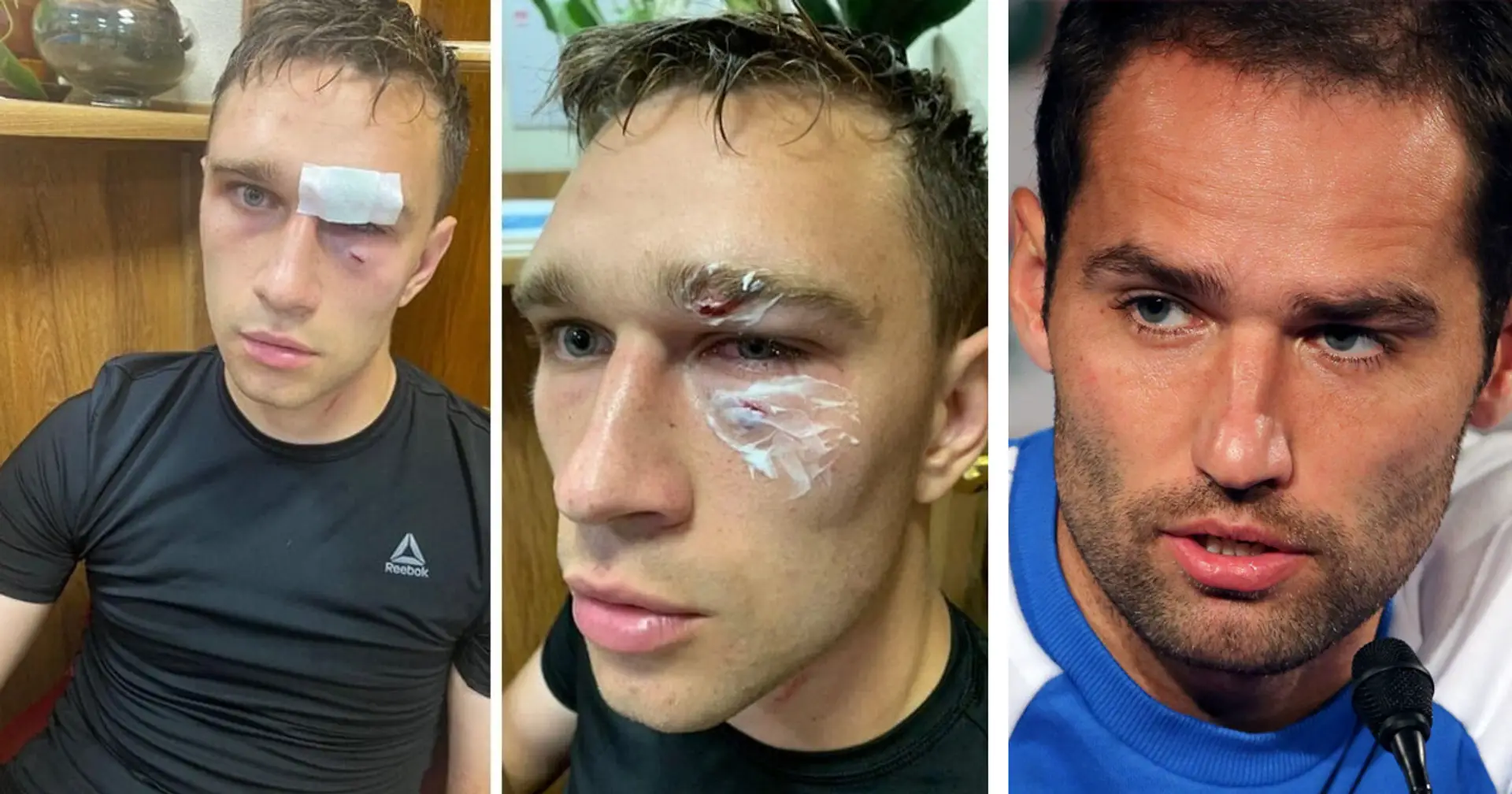 Former Russia's NT captain Roman Shirokov lands amateur league referee in hospital after on-pitch brawl