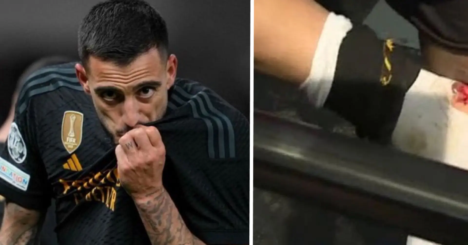 'Blood and sweat': Joselu shares bloody picture of his ankle after Union Berlin game