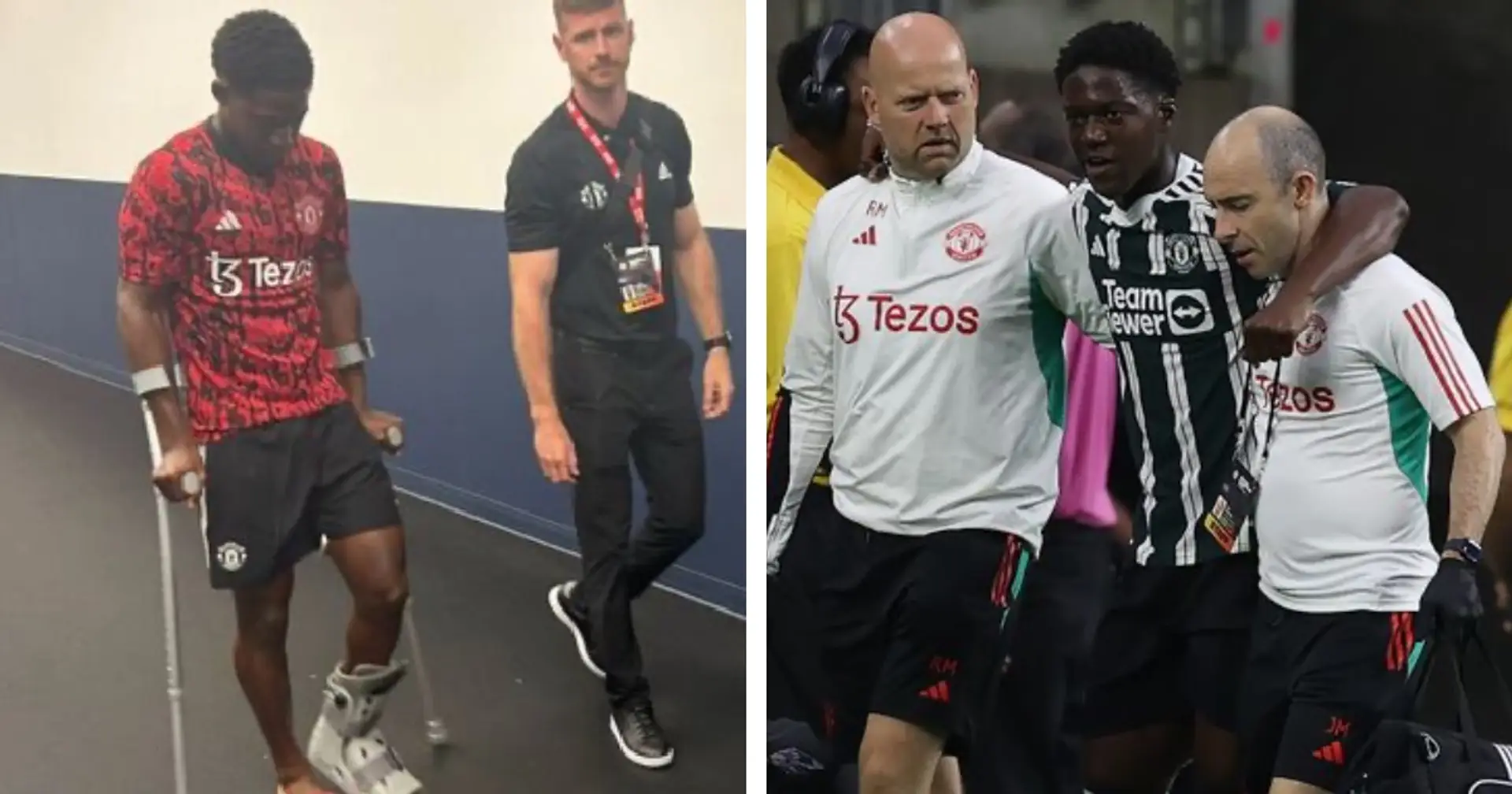 Kobbie Mainoo gives injury update & 2 more latest under-radar Man United stories