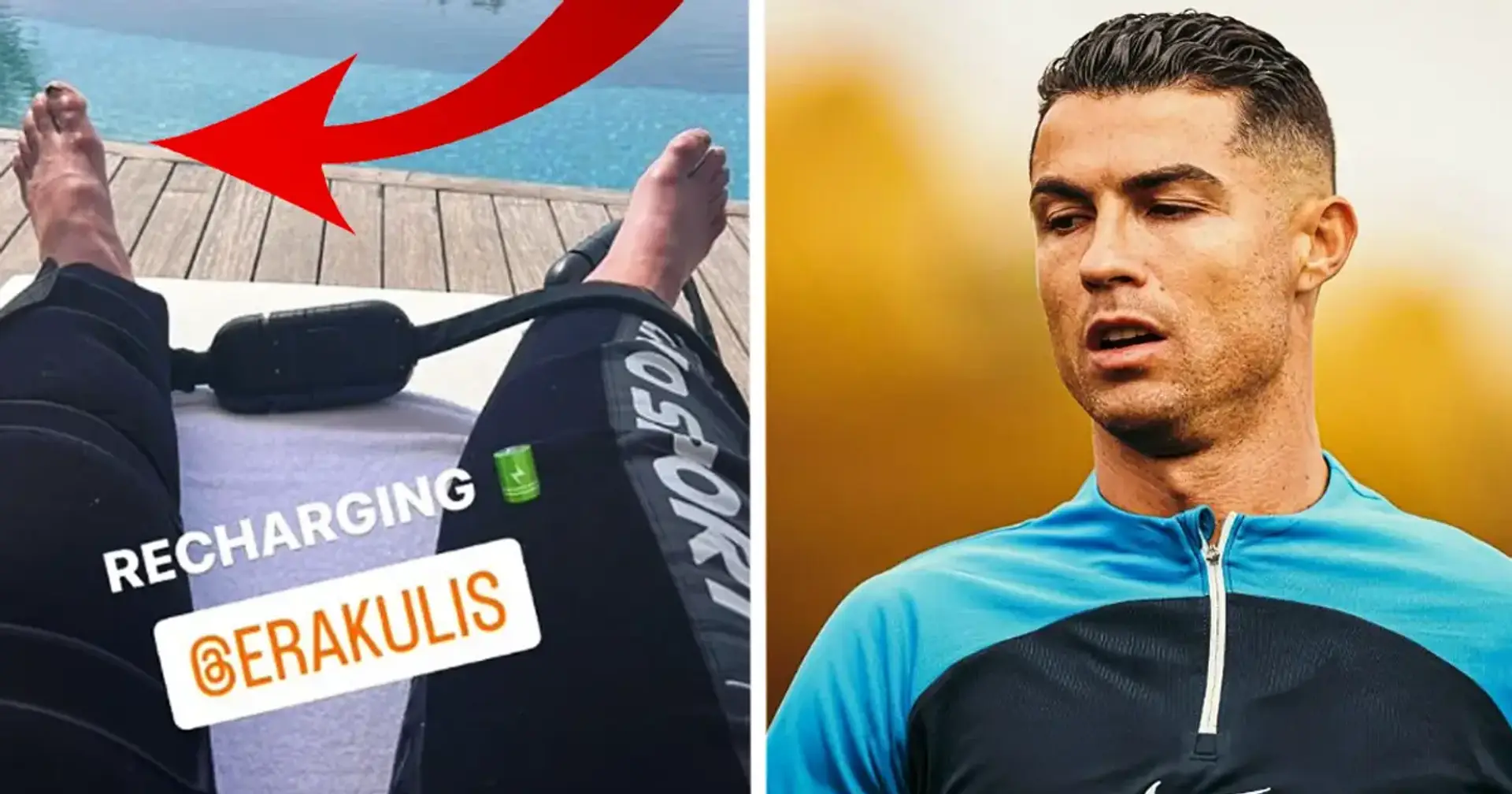 "Seine Zehen schreien um Hilfe": Ronaldo schockiert Fans mit Foto seiner Genesung