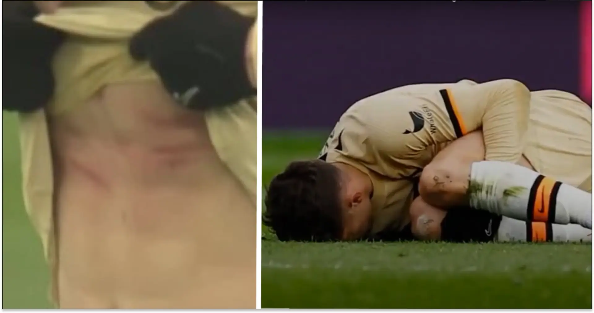 Spotted: Stud marks on Havertz's body after Amartey's brutal foul — not even a booking for Leicester player