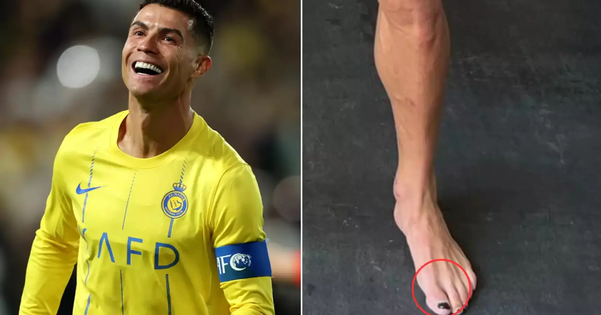 Ronaldo hat seine Zehennägel wieder lackiert: Nicht aus ästhetischen Gründen - so erholen sich viele Sportler