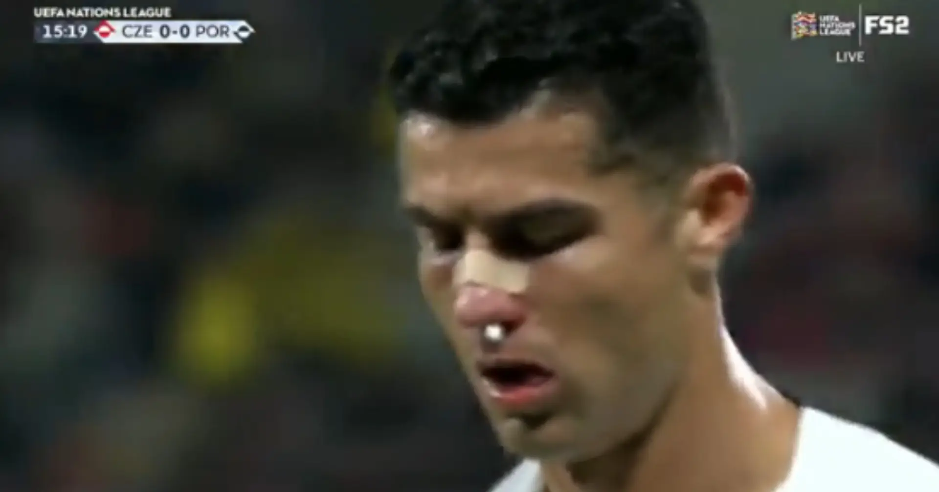 Cristiano Ronaldo sends message to fans after being left with bloodied nose